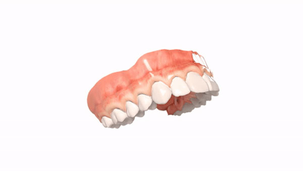 teeth Image